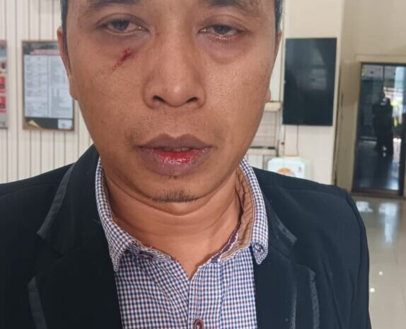 Mengamuk Usai Sidang Cerai, PNS Aniaya Advokad di PA Madina